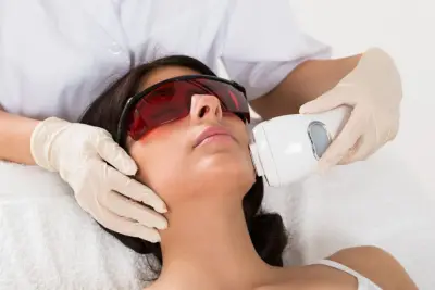 Comment fonctionne une épilation laser?